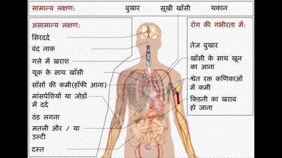 डीएसटी ने कोविड 19 से बचाव में नाक छिद्र में उपयोग किए जाने वाले एक जैल के विकास के लिए वित्तपोषण को दी स्वीकृति 